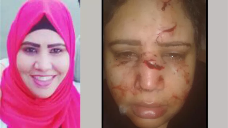 بلطجية يعتدون بالضرب على ” محامية ” بالأميرية (صور)
