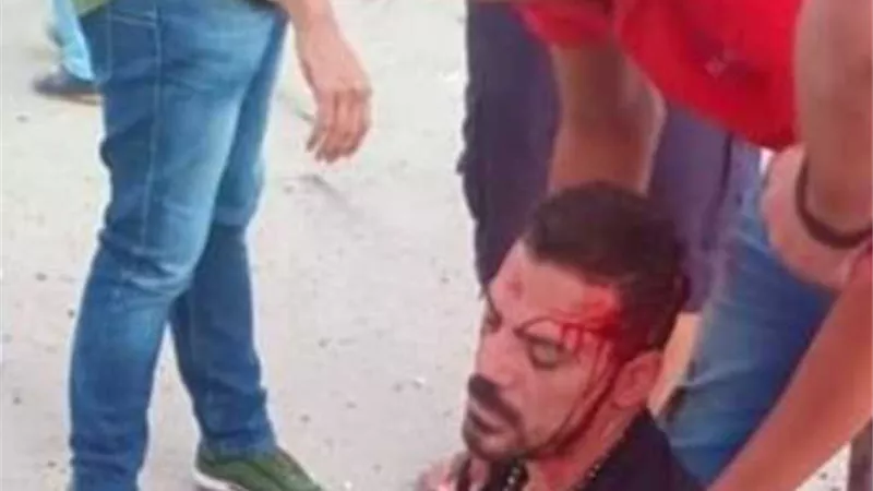 عمرو زكي يطمئن جمهوره بعد حادث السير: «هرجع أحسن من الأول» (فيديو)