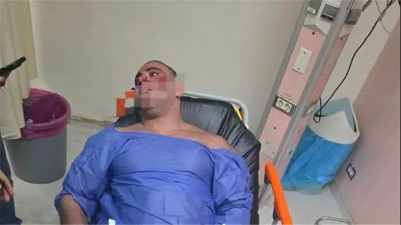 خناقة ورصاص ودمـ.ـاء.. القصة الكاملة لإطلاق بودي جارد الرصاص على مدير جولدن جيم بالشيخ زايد