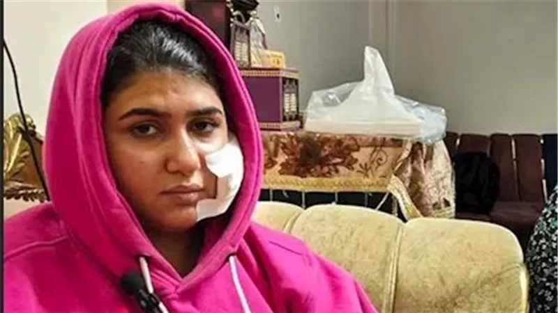 خلعته قبل الدخلة.. جزار بلبيس يُشوّه وجه عروسه ويُطلق عليها كلبًا شرسًا