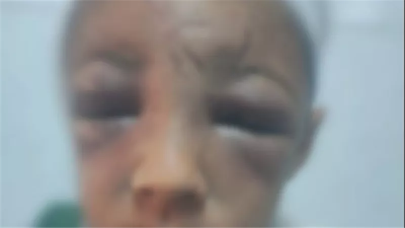 ضيع 10 جنيه باقي ثمن علبة سجائر.. أب يعذب ابنه بطريقة بشعة في الغربية | فيديو