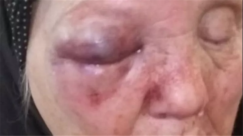 تفاصيل صادمة.. الابن العاق ضرب أمه للحصول على أموال لشراء مخدرات بالغربية