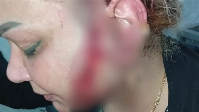 تفاصيل القبض على المتهم بطعن طليقته في السيدة زينب بعد إصابتها بأكثر من 240 غرزة 
