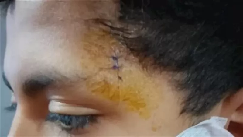 مأساة صلاة التراويح.. طفل الخانكة يشوه وجه آخر بكتر داخل مسجد 