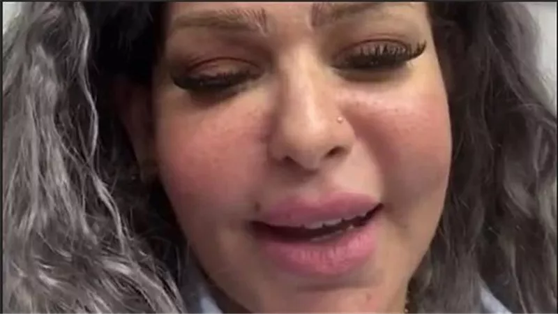 قالي اتعالجي في الزريبة.. تفاصيل مشاجرة إيمي تاتو في مستشفى بمصر الجديدة | فيديو
