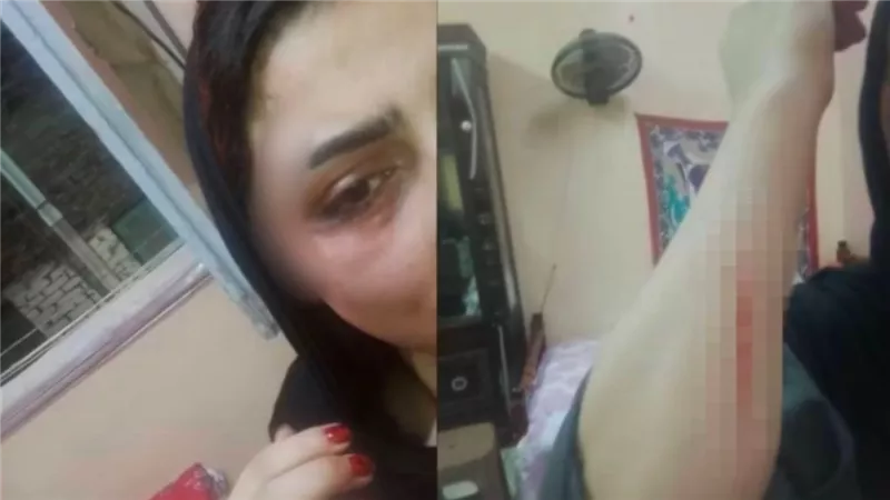 مسكته بيخونها.. تفاصيل التحقيق مع المتهم بالتعدي على زوجته في حلوان 