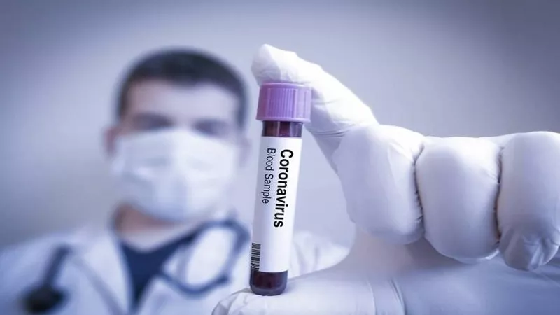 بعد ظهور دراسة تثبت انتقال «كورونا» عن طريق الكلام.. رئيس شركة أدوية يوجه نصيحة هامة | فيديو