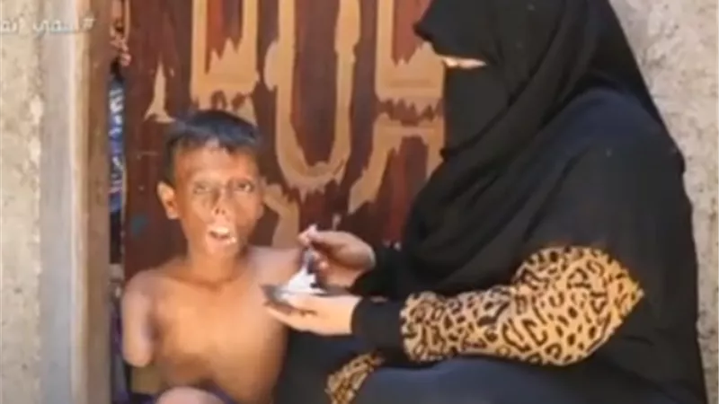 مأساة الطفل زياد.. «اشتعلت الدفاية فيه وأجرى 12جراحة» | فيديو