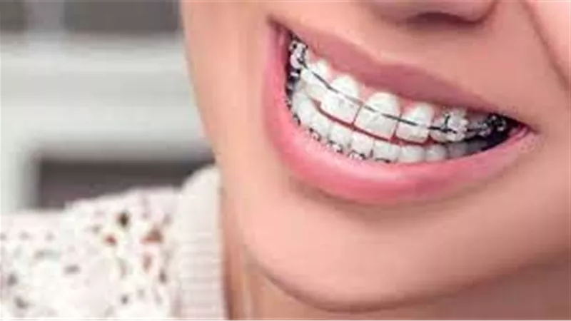 طبيب: المريض عليه ألا يتدخل في اختيار المادة المستخدمة في زراعة الأسنان | فيديو
