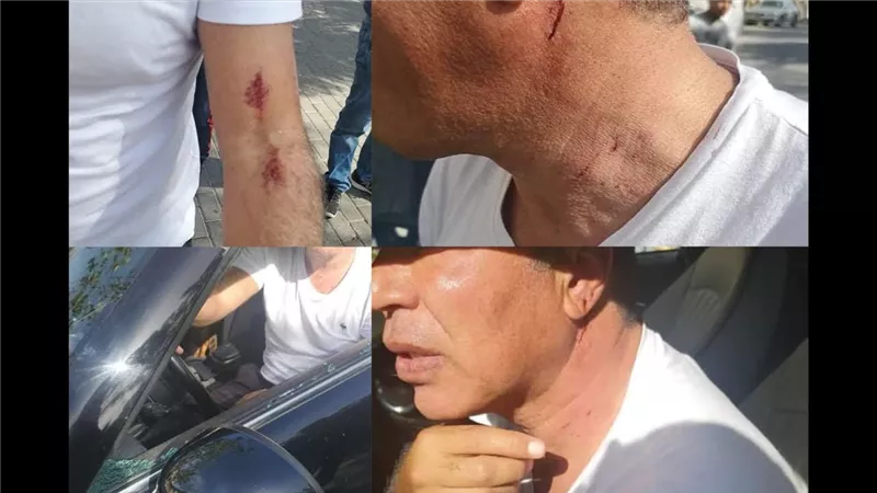 جماهير الزمالك ضربته بالطوب.. تفاصيل ساعات رعب عاشها أيمن يونس | صور