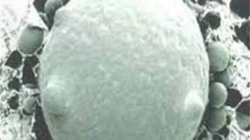 هؤلاء الأكثر عرضة للإصابة..لماذا الفطر الأبيض أخطر من الأسود ؟ 
