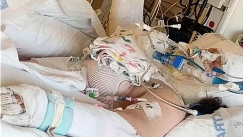 بسبب حيلة بـ التيك توك.. فتاة تشعل النار في نفسها وتصاب بحروق خطيرة