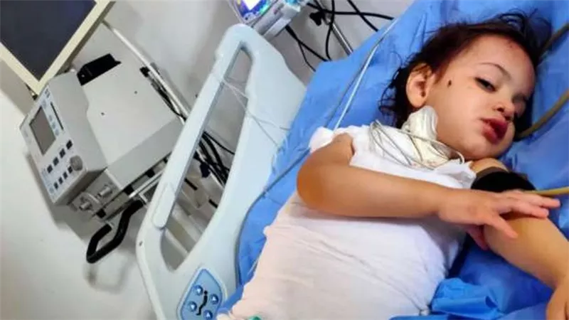 قلوب بلا رحمة.. عم وعمة يعذبون طفلة بيطفوا السجاير بجسمها