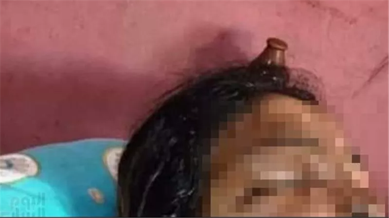 شوه جسمها بمية نار.. سائق ينتقم من طليقته: 8 سنين مبتخلفش وخلعتني