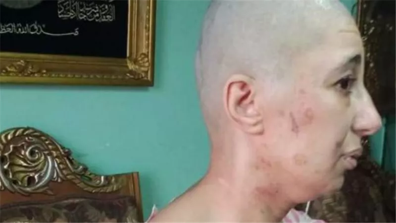عشان مزاجه.. معاناة «شيماء» مع زوجها 15 سنة حلاقة زيرو وتعذيب وتسول| شاهد 
