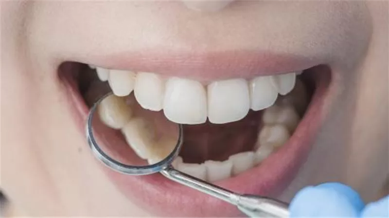 خلى بالك.. معاناة الأسنان من هذا الأمر دليل على إصابتك بـ السرطان