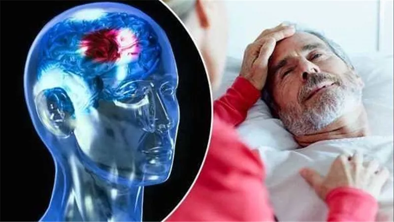 احذر.. علامات على وجه الإنسان تنذر بحدوث وشيك للسكتة الدماغية