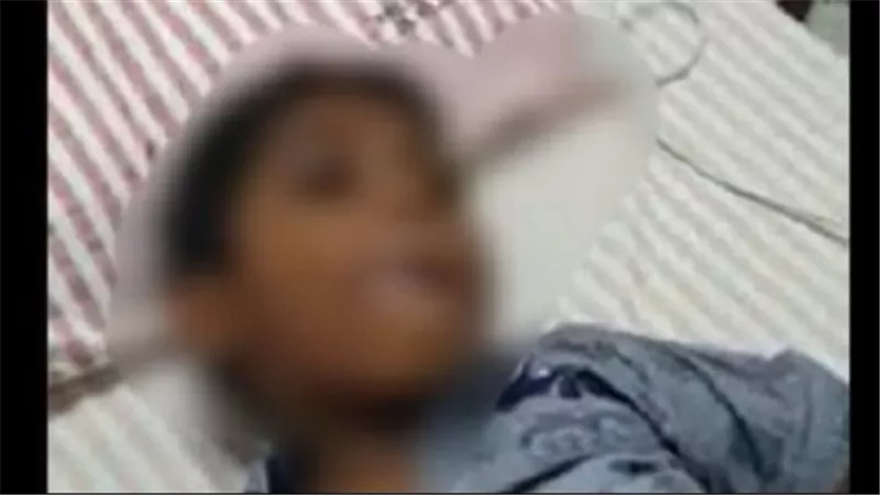 عضه كلب مسعور ولم يحصل على المصل.. قصة حزينة لطفل «بيهوهو»
