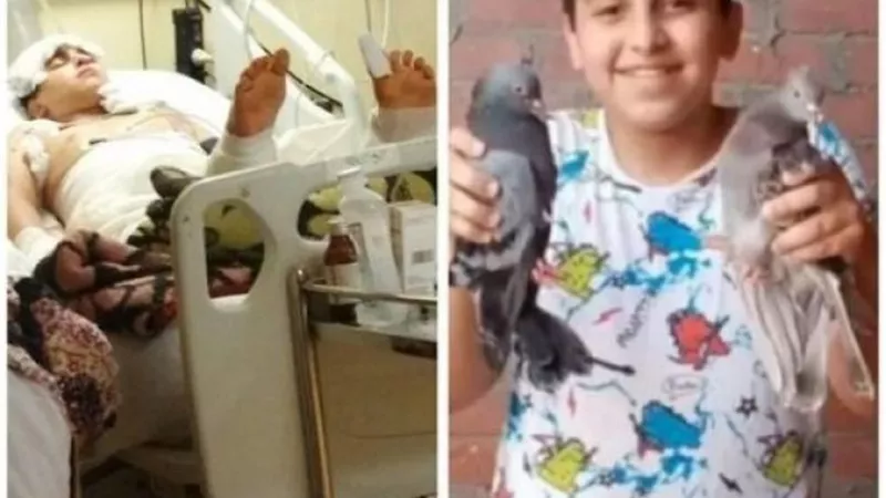 جسمه بيتقطع أنقذوه.. لعب عيال انتهى بحرق «أحمد» بالبنزين