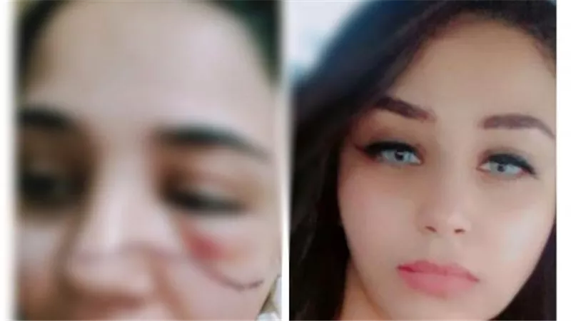 شكلي راح واتجوزته برده..منة رفضت عريس شقيقتها فشوه وجهها