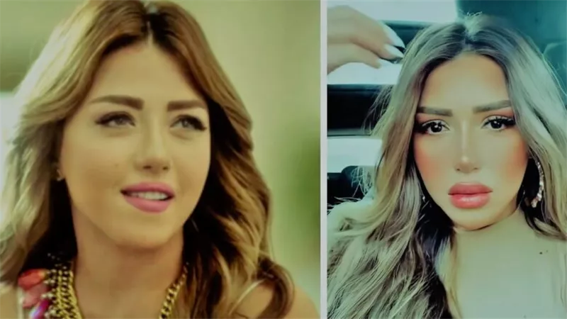 بعد فترة اختفاء.. هل خضعت سارة سلامة لعملية تجميل؟ | صور