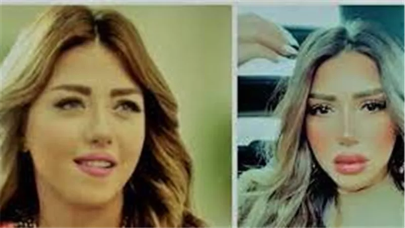  آخرهن سارة سلامة..نجمات صدمن الجمهور بإطلالاتهن بعد عمليات التجميل | شاهد