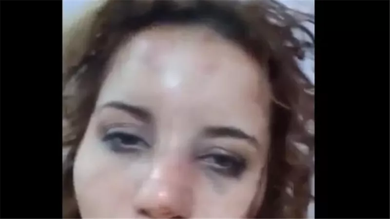 وشها كله جروح وكدمات.. سيدة تستغيث من زوجها: بيكتفني ويرفع عليا المطواه | فيديو