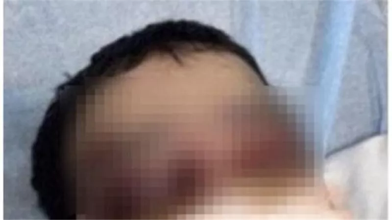 قطع لسان وفقأ عين.. قصة مأساوية لـ معنفة جدة مع زوجها