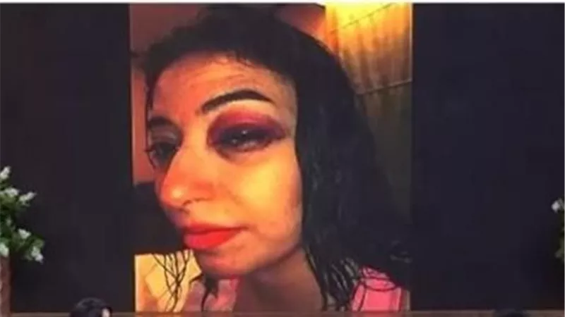 عيني كانت هتروح.. ماذا حدث لـ غادة رجب بعد حفل زفافها ؟