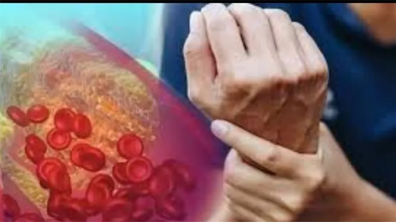 3 أعراض خطيرة وخادعة.. علامات ارتفاع مستوى الكوليسترول في الدم