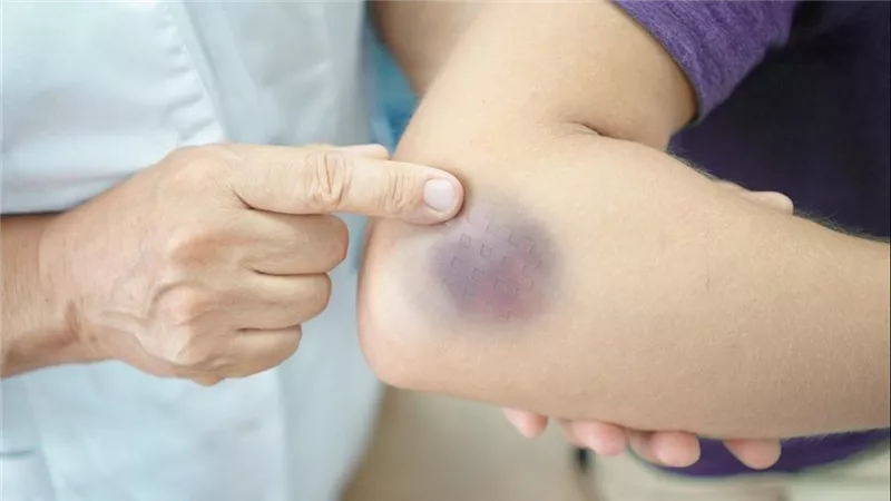 احذر منها..8 علامات إذا رأيت إحداها على جسمك فاذهب للطبيب فورا