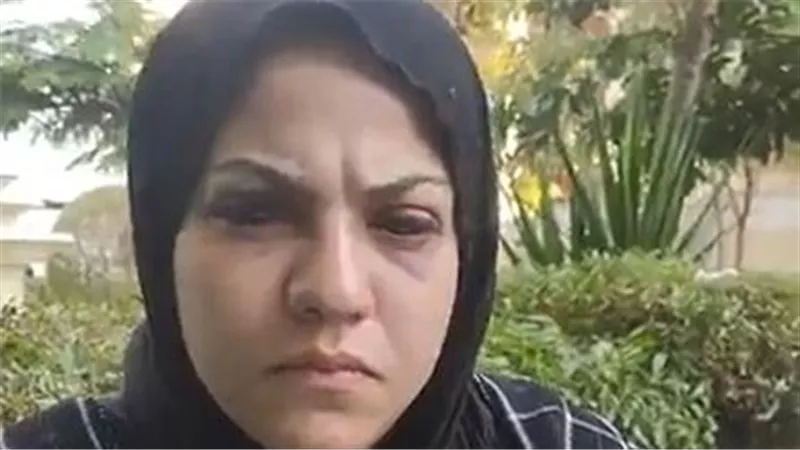 ضربني بالكورباج ومضاني على تنازلات.. سيدة تروي تفاصيل مأساوية عن اعتداء زوجها عليها