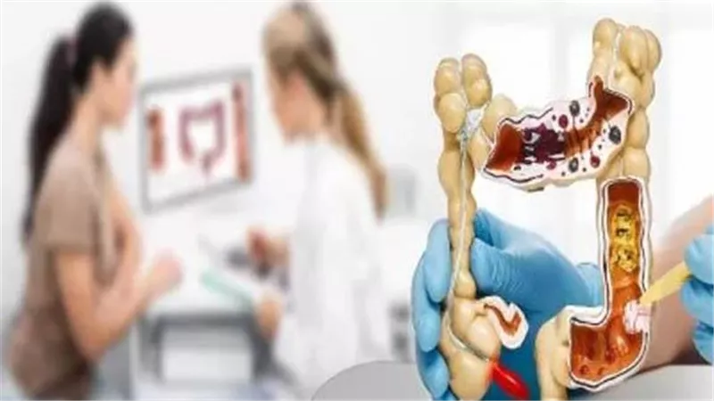 لقولون أكثر صحة.. احرص على تناول هذه الأطعمة الـ 6