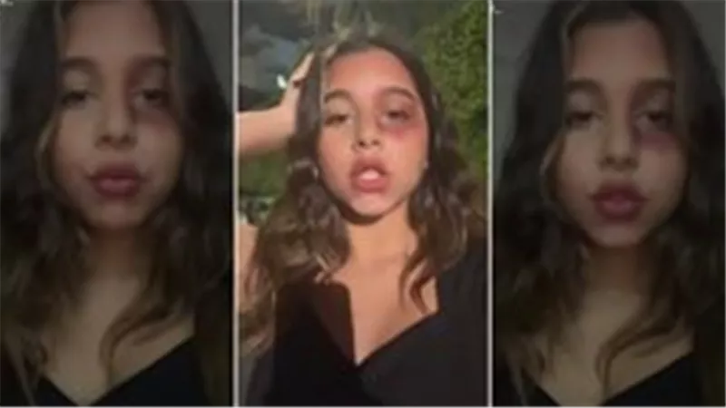 بعد انتشار فيديو أثار قلق الجمهور.. ابنة شيرين عبدالوهاب تكشف حقيقة تعرضها للضرب | شاهد