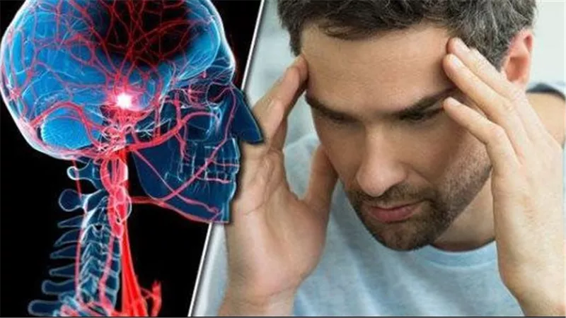  انتبه إليها.. 4 علامات تكشف إصابتك بسكتة دماغية صغيرة