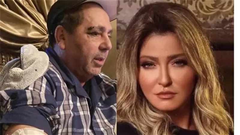 وشه بايظ وحاجبه مفتوح.. أول صور لزوج علا غانم بعد تعرضه للضرب | شاهد