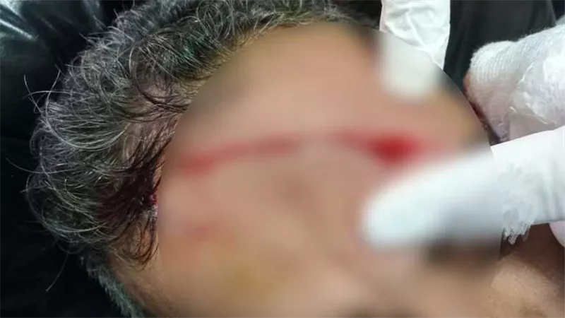 صراخ داخل قسم الحضانات.. أول تعليق من الطبيب المعتدى عليه بمستشفى كفر الزيات