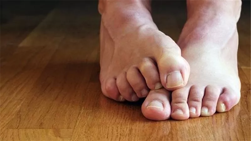 إذهب للطبيب فورا.. علامتان على أظافر القدمين تنذران بالإصابة بالقاتل الصامت