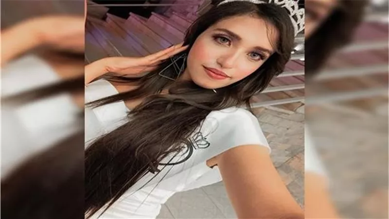 قطع وشها قبل الفطار.. ماذا حدث لـ ملكة جمال النيل بالجيزة؟