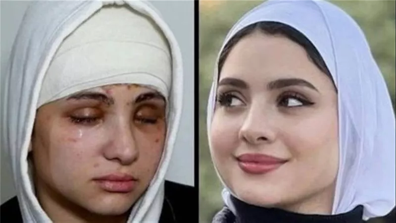 لسه فيه أمل..مفاجأة لـ البلوجر سارة محمد بعد فقدانها بصرها | فيديو