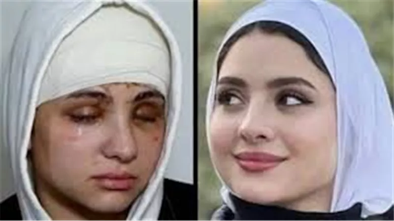  صديق عمرها..صور خطوبة البلوجر سارة محمد بعد فقدان بصرها تشعل السوشيال ميديا | شاهد 