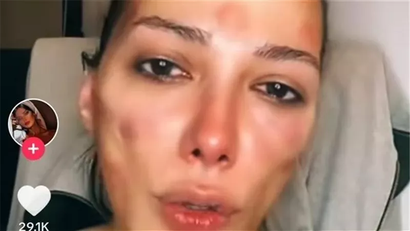 الدكتور قاللي عندك شيطان في وشك.. حكاية مأساوية لفتاة ضحية مركز تجميل | فيديو