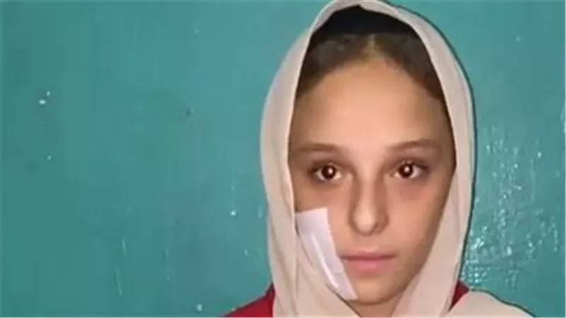 الأم ضربتها والابن شوه وجهها.. تفاصيل مثيرة في الاعتداء على فتاة المرج
