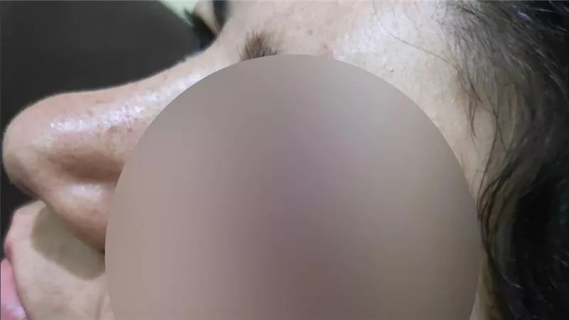 فقأ عينيها والسبب صادم.. تفاصيل مثيرة في مأساة ممرضة السلام مع تاجر المخدرات