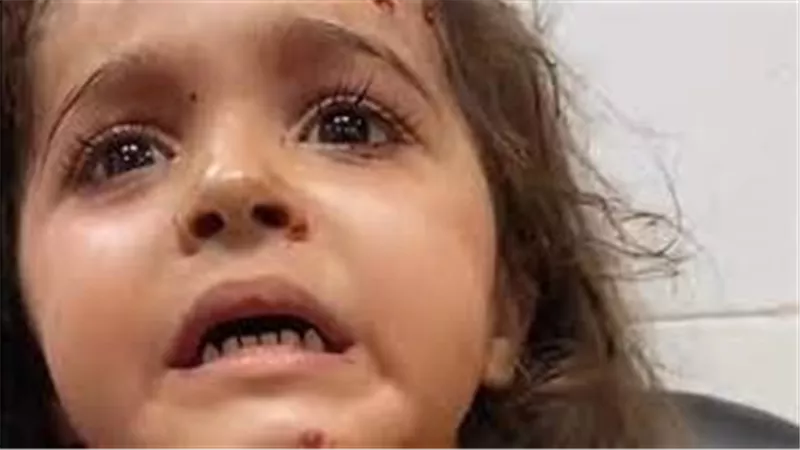 قصفوا أمي وقصفوني.. فيديو مبكي لطفلة من غزة بعد استشهاد والديها | شاهد