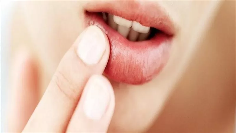احذرها..علامات إذا ظهرت على شفتيك دليل على الإصابة بهذا المرض