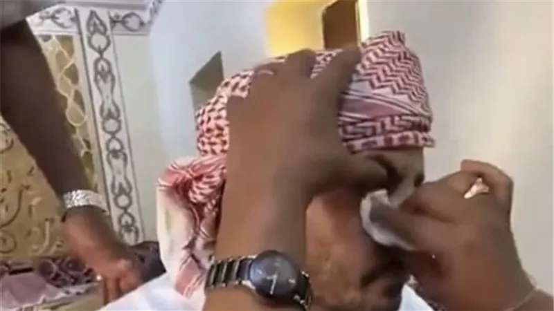  بالفهلوة..مقطع فيديو يثير الجدل بالسعودية لمحاولة إخراج «حجر» من عين مريض دون جراحة | شاهد
