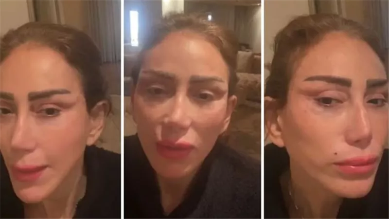 وشها مفتوح.. مقطع فيديو صادم لـ ريهام سعيد من داخل غرفة العمليات | شاهد