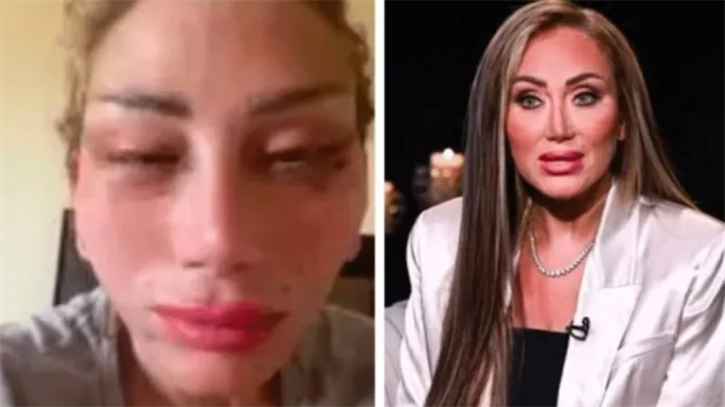 فيديو صادم من العمليات.. ريهام سعيد تفجر مفاجأة جديدة بعد تشويه وجهها | شاهد