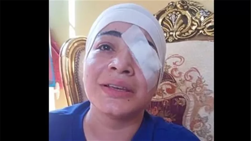 عينيها راحت.. كواليس ومفاجآت جديدة في الاعتداء على ممرضة شبرا العام